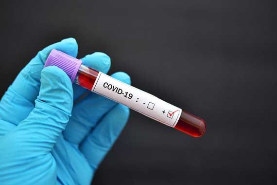 Un échantillon de sang positif au COVID-19.